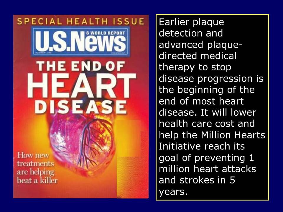 Beginning of the End of Most Heart Disease