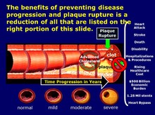 Benefits of Preventive Treatment