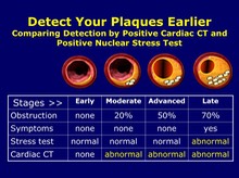 Detect Your Plaques Earlier and Live