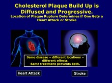 Heart and Stroke Same Process