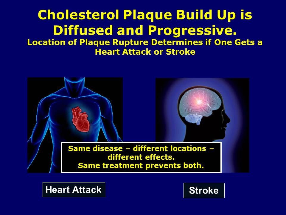 Heart and Stroke Same Process