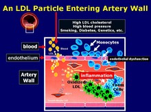 LDL Entering Artery Wall