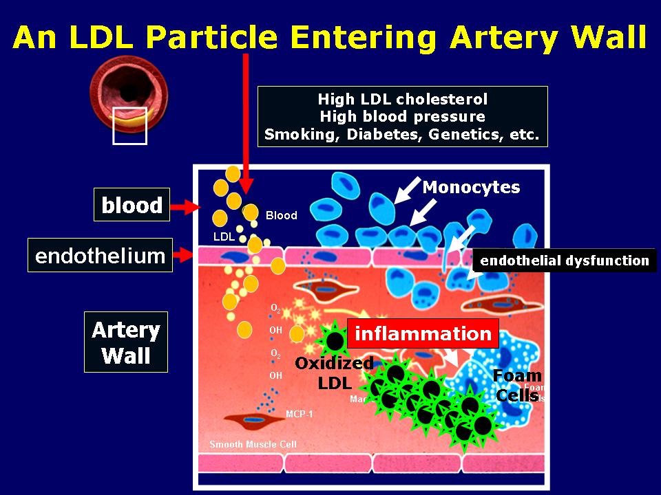 LDL Entering Artery Wall