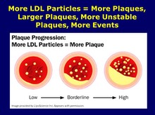 More LDL Particles, More Plaques