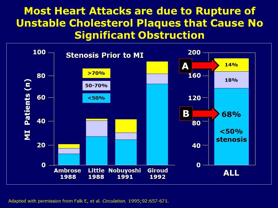 Most Heart Attacks not due to severe obstruction