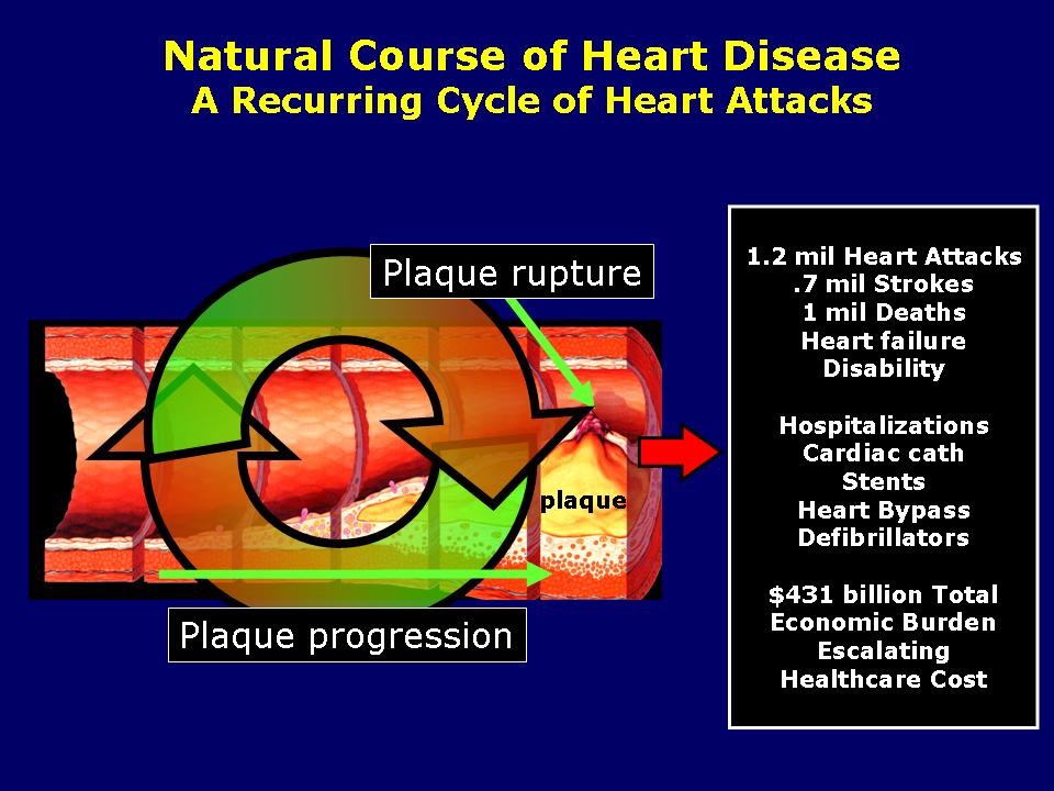 Natural Course of Heart Disease