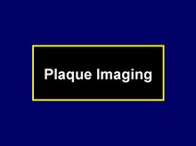 Plaque Imaging