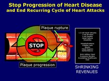 With Stabilization-Regression Therapy - Shrinking Revenues