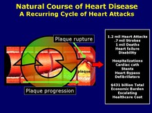 Without Prevention - Increasing Revenues