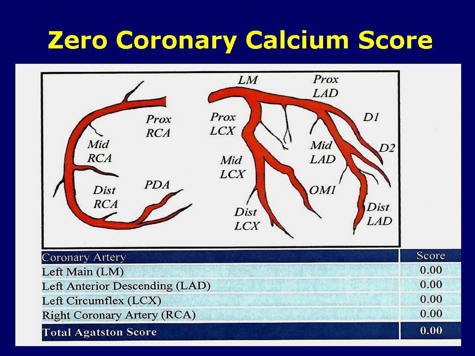 Zero Coronary Calcium Score Advanced Cholesterol Clinic RdeGoma